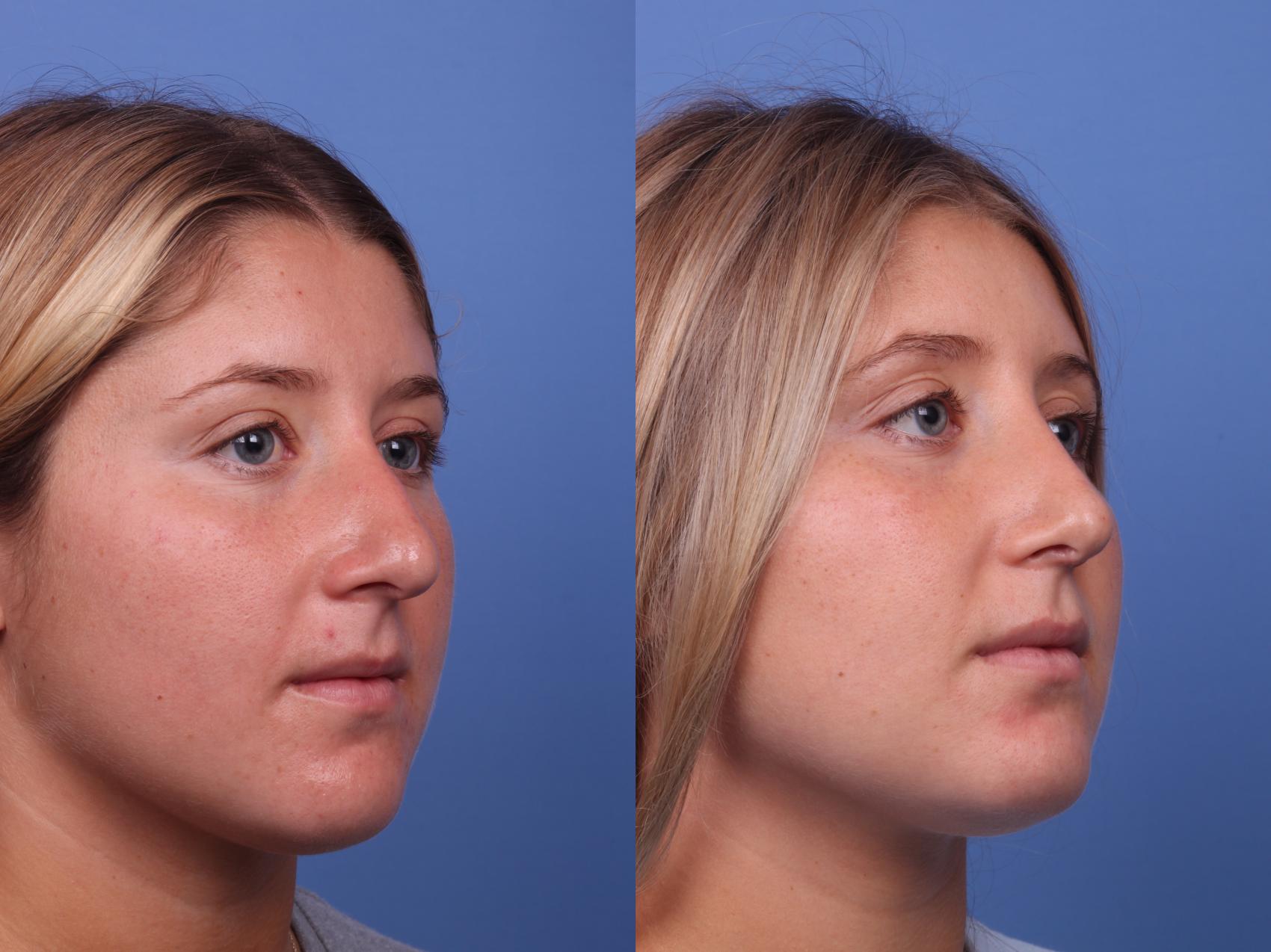 Zuri Plastic Surgery Reviews - exh7sk8