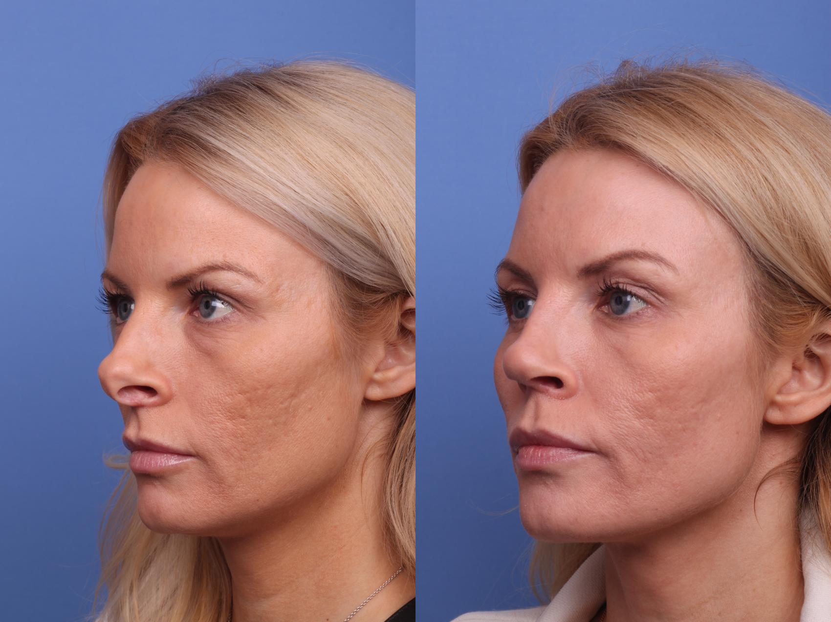 Zuri Plastic Surgery Reviews - fw1u5l7